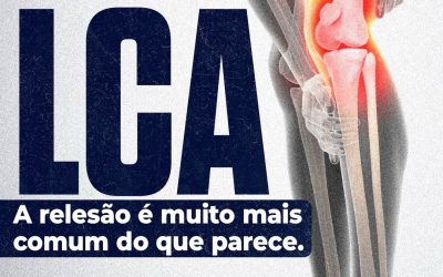Relesão do LCA: confiar apenas no visual é um risco?
